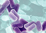 Cystite, on comprend mieux comment la bactérie E.Coli s’attache au tractus urinaire