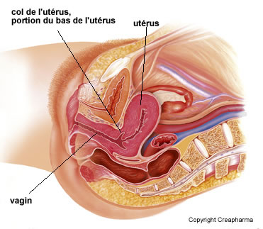 Cancer Du Col De L Uterus Symptomes Traitements Creapharma