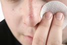 Décoction contre l'acné