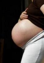 Huile d'amande douce - prévention des vergetures (pendant la grossesse)