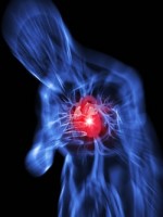 Risque de crise cardiaque et d'AVC doublé chez des patients souffrant de goutte
