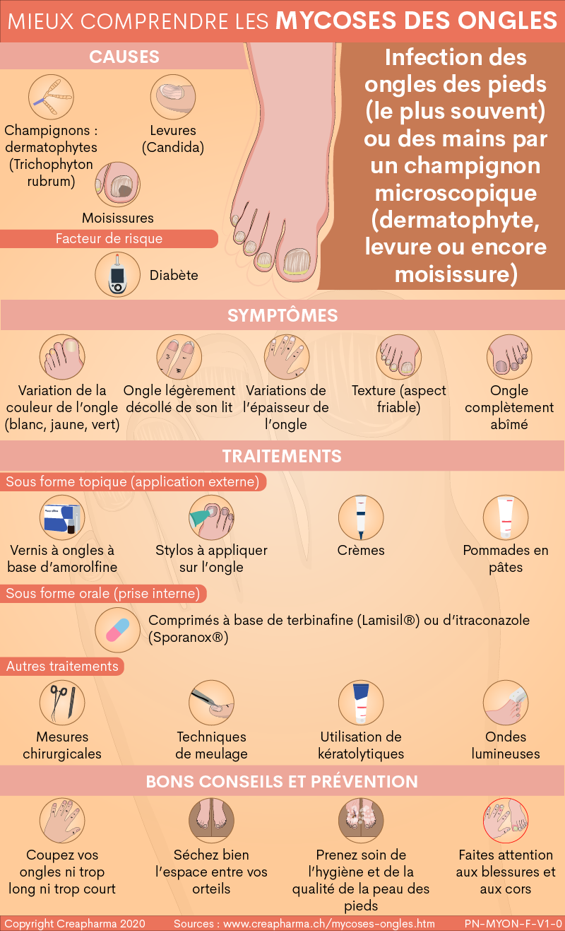 Mycose des ongles : prévenir et traiter l'onychomycose - Conseils santé